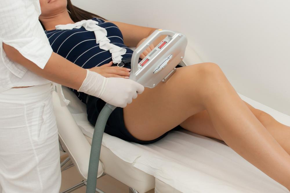 Epilation définitive près de La Roche sur Foron