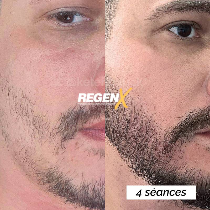 img 1